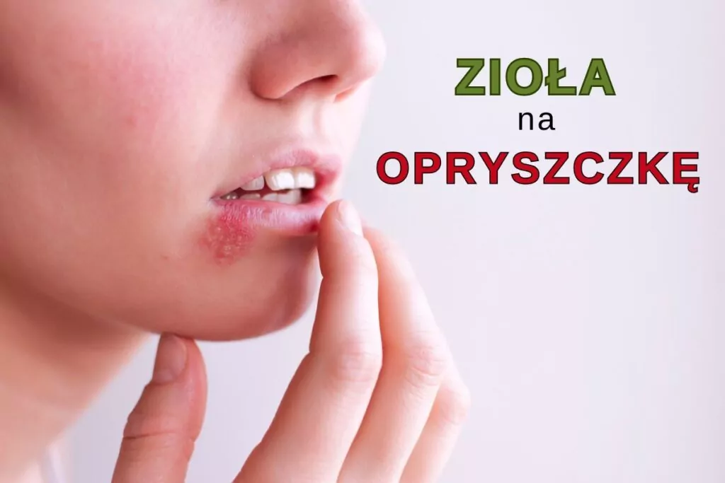 Jak skutecznie leczyć opryszczkę? Naturalne i farmakologiczne sposoby Jak skutecznie leczyć opryszczkę? Naturalne i farmakologiczne sposoby